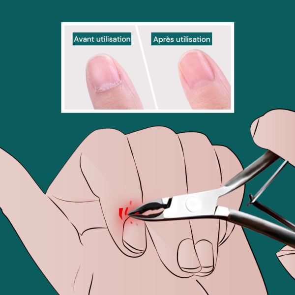MR Pince cuticules verte manucure des ongles ciseaux cuticules tondeuse dissolvant de peau morte p dicure 1