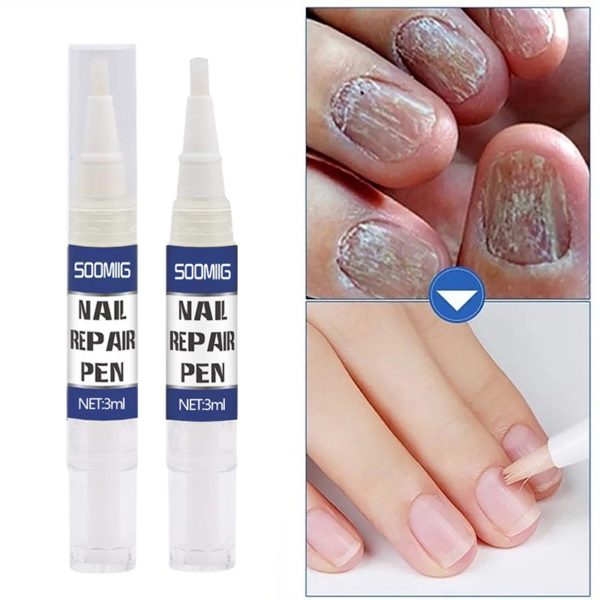 Stylo à ongles 3ML, traitement antifongique, Infection Paronychia, à base de plantes, pour orteils, accessoires de beauté, santé – Image 4